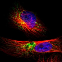 TIMM9 Antibody, Novus Biologicals 25 &mu;L; Unlabeled:Antibodies, Polyclonal